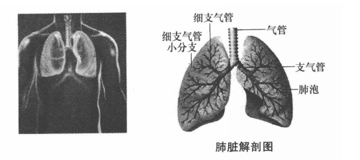 肺功能检查项目有哪些