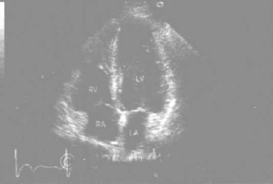 心脏B超可以判断哪些疾病_各种疾病