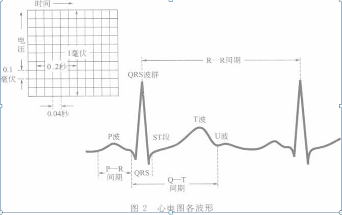 如何看懂心电图的结果_注意这些要点