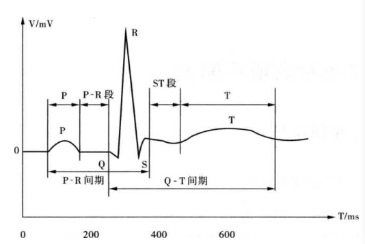 心电图的波形是什么呢？