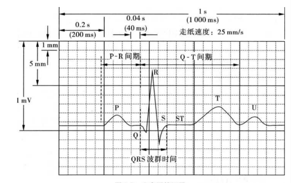 心电图记录纸和检查注意事项有哪些呢？