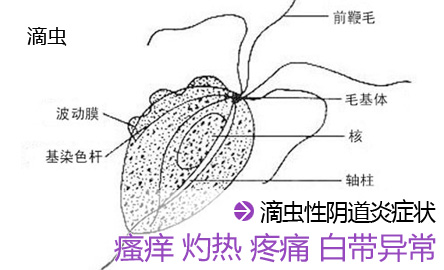 滴虫感染